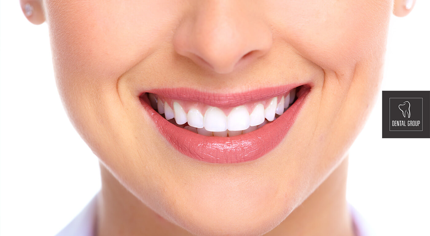 Profesionálne bielenie zubov Opalescence Boost - váš úsmev bude belší o 3-7 odtieňov!